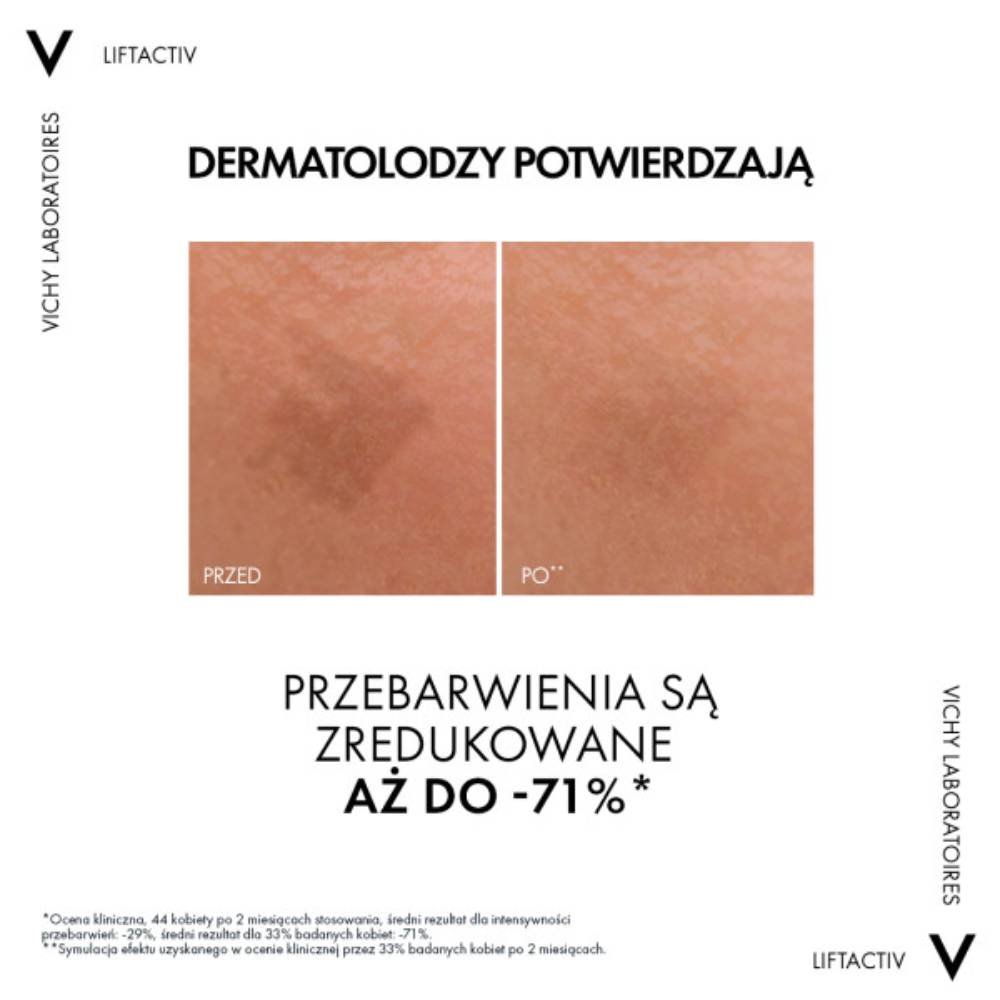 Efekty stosowania produktu.